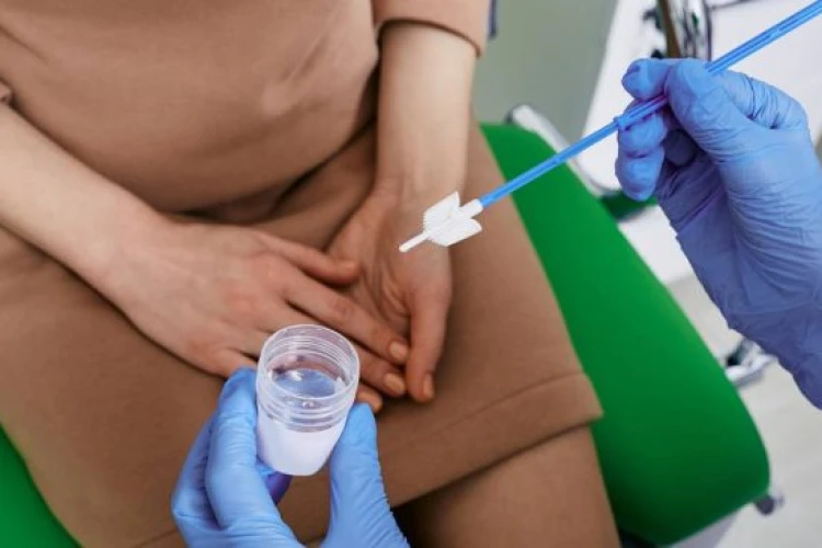 Papanicolaou en Guadalajara