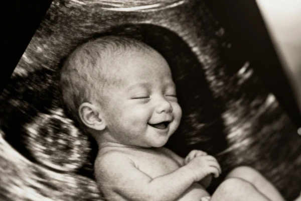 Ultrasonido Estructural en Guadalajara